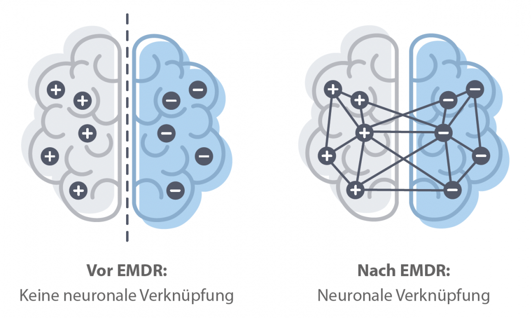 Wie Lange Wirkt Emdr Nach praxis-neurofeedback.com